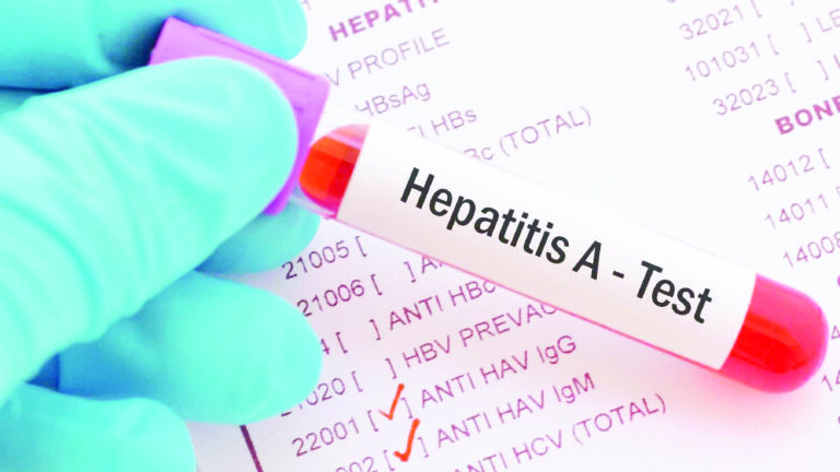 Hepatite A – Saiba tudo Sobre